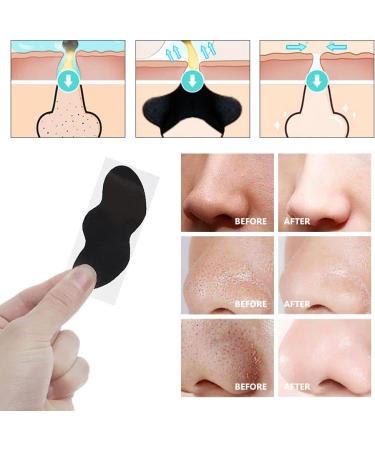 Blackhead Nose Strips Nose Strips Anti Nosestripes Blackheads 20 Pieces Pore Strips Pore Cleaning with Activated Carbon Remove Blackheads and Impurities with Blackhead Remover Comedone - Buy Online on GoSupps.com