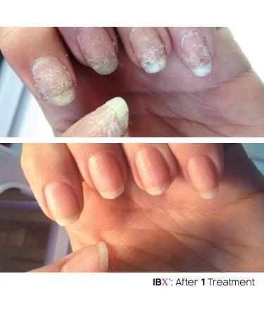 Buy IBX Mini Duo Pack Nail Polish | FREE Dadi Oil | Restore & Protect Your Nails Internationally - Buy Online on GoSupps.com