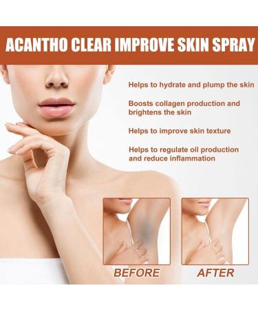 FOIDL Acantho Clear Therapy Spray - Acanthosis Nigricans & Dark Spot Remover - 30ml - Buy Online on GoSupps.com