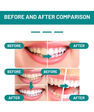 Teeth Whitening Mouthwash - Total Care Dental Foam for Refreshing Breath & Deep Cleaning (2pcs) - Buy Online on GoSupps.com