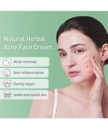 Anti Acne Removal Cream - Acne Treatment Spot and Blackheads Treatment - Day & Night Acne Gel Set - Moisturizing Skincare Fade Acne Spots Oil Control Shrink Pores - For All Skin Types 2x30ml - Buy Online on GoSupps.com