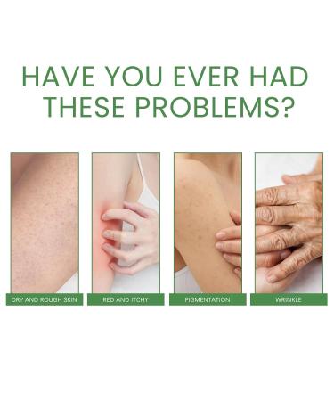 OLLZPJFPK Firming Collagen Body Cream Moisturizing Repairing Keratosis Pilaris Anti-Dryness Smooth Skin Whitening Beauty Skin - Buy Online on GoSupps.com