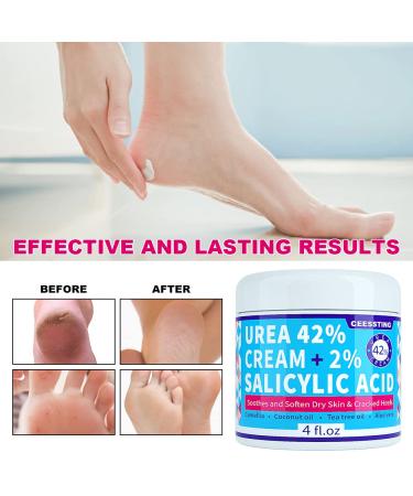 ENVISHA 42% Urea Cream for Feet w/ Salicylic Acid & Hyaluronic Acid - 4 oz - Moisturizer for Hands, Heels, Elbows, Nails & Knees - Buy Online on GoSupps.com