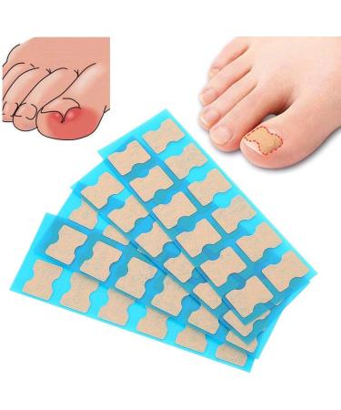 Ingrown Toenail Correction Patch - 4 Sizes, Glue-Free Toe Nail Corrector for Paronychia, Foot Care Treatment - Pedicure Tool - Buy Online on GoSupps.com