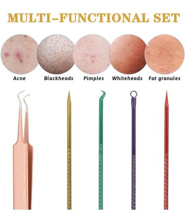 Aruicheng Blackhead Remover Tool Pimple Popping Kit Stainless Steel Comedone Extractor Tools with Storage Box for Removing Pimple Blackheads Acne Zit on Face 5 Pcs - Buy Online on GoSupps.com