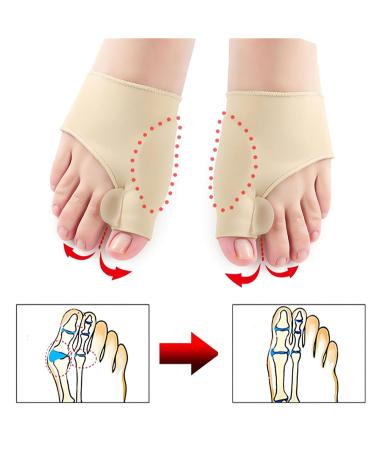 Diameleo Premium Bunion Corrector Socks - Hallux Valgus Relief for Women and Men (Small, 3 Pair Black) - Buy Online on GoSupps.com