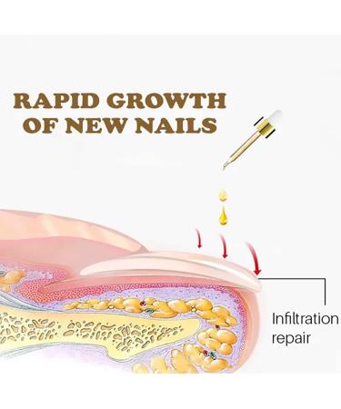 NailGrowth DeepHealing Organic Serum NailGrowth Nail Serum Reconstrux Nail Growth Nail Growth and Strengthening Serum Nail Serum for Growth and Repair for Damaged Nails (3pcs) - Buy Online on GoSupps.com