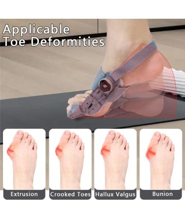 Bunion Corrector for Women & Men - Adjustable Bunion Splint for Pain Relief | Anti-Slip Heel Strap & Silicone Pad | Fits Left & Right Feet - Buy Online on GoSupps.com