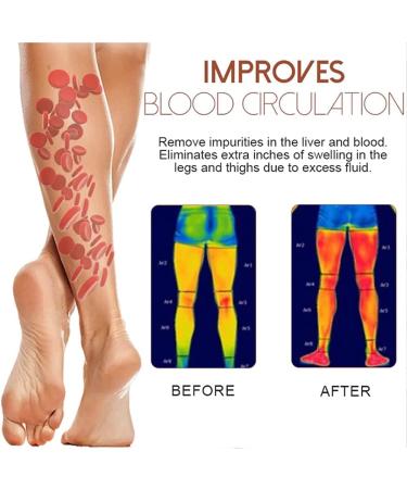 Mediginger Anti-Swelling & Cellulite Firming Ointment for Legs (5PCS) - Buy Online on GoSupps.com