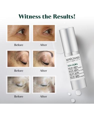 Buy Repechage Vita Cura Opti-Lift Serum - Anti-Aging Eye Contour Treatment for Wrinkles & Crow s Feet - 15ml | International Shipping Available - Buy Online on GoSupps.com