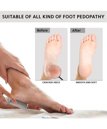 Stainless Steel Pedicure File - Buy Online on GoSupps.com
