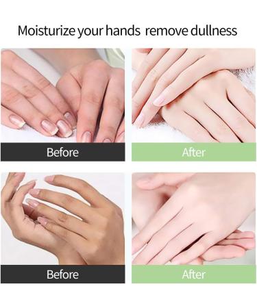 MOND SUB Coconut Oil Hand Mask Gloves for Dry Hands Set of 5 Pairs Moisturizing & Whitening Anti-Aging Hydrating Hand Care Gloves Soften Cutin/Supplement Nutrition Exfoliating - Buy Online on GoSupps.com