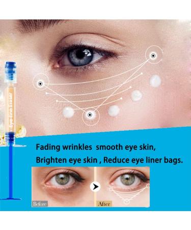 Eye Line Eraser Cream - Anti Aging Wrinkle Treatment for Under Eyes & Forehead - Instant Smoothing Formula with Moisturizing Benefits - Reduce Fine - Buy Online on GoSupps.com