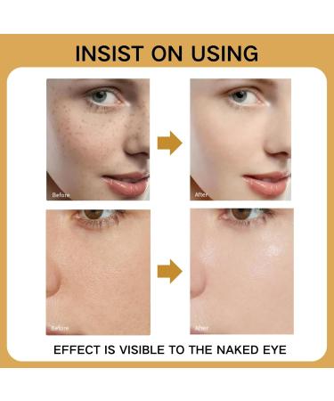Dark Spot Correcting Glow Serum - Niacinamide Serum - Hydrating Face Serum for Women - Dark Spot Remover for Face - Hyaluronic Acid Serum - Improving Skincare - Hydrating Anti-Aging Facial Essence - Buy Online on GoSupps.com