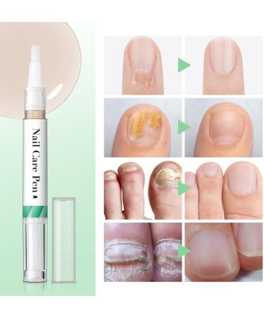 Nail Growth Oil | Repair Damaged Nails Add Shine Strengthen Nail Moisturizer Strengthener Nail Renewal Liquid Nail Growth Oil Nail Care Nail Growth Oil Nail Care Pen Nail Nourishing Care Nail Oil - Buy Online on GoSupps.com