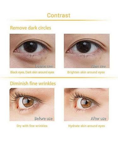 Silicone Eye Patch Combo Set Reusable Wrinkle Facial Forehead Facial Patch Removal Sticker Pad Eye - Buy Online on GoSupps.com