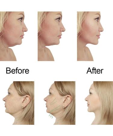 V Line Mask - Contour Lifting Neck Mask for Moisturizing & V-Shaped Facial Care | International Shipping Available - Buy Online on GoSupps.com
