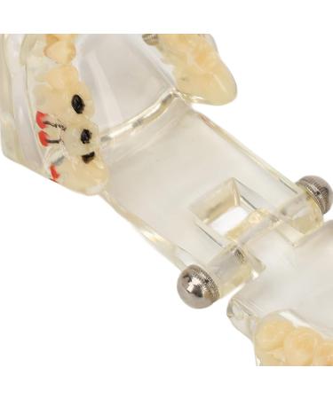 Buy Verdant Touch Transparent Dental Implant Model - Ideal Teaching Aid for Pathology & Dental Studies | International Shipping Available - Buy Online on GoSupps.com