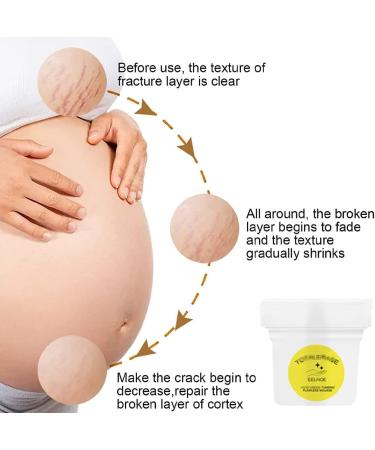 Organic Flawless Firming Cream & Turmeric Mousse for Stretch Marks - 30g (2 PCS) - Buy Online on GoSupps.com