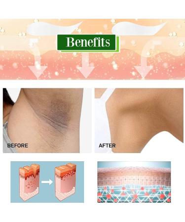 Brightening Cream For Brightening Cream For Dark Skin Armpit Elbow Neck Deodorant Brightening Cream - Buy Online on GoSupps.com