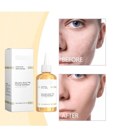 Gentle Toner for Skin Barrier Repair - Hydrating Non-Greasy Facial Toner to Nourish & Fight Acne Improve Skin Issues(1PCS) - Buy Online on GoSupps.com