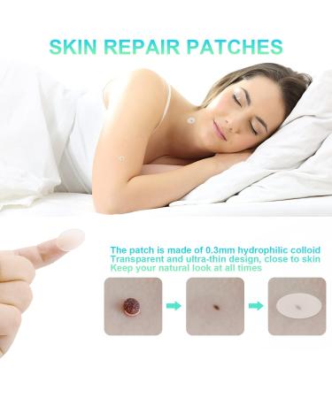 New Version Auto Skin Tag Remover Kit 2-Set Painless Skin Tag Removal Kit Tools for (1-9mm) Skin Tags (includes 100 Removal Bands & 36 Repair Patches & 20 Pcs Cleansing Wipes) Blue Green 2pcs Kit - Buy Online on GoSupps.com