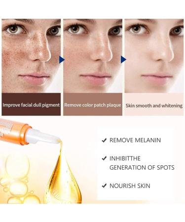 Kybbe Whitening Anti-Spot Cream 15g Removes Melasma Acne Spots Pigment Melanin Face Care Cream - Buy Online on GoSupps.com