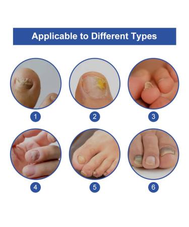 Premium Nail Care & Treatment | Repair Broken & Discolored Nails with Nourishing Nail Oil & Serum for Healthy Hands & Feet - Buy Online on GoSupps.com
