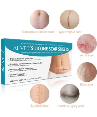 Silicone Scar Sheets for C-Section Surgery, Burn, Keloid, Acne - 4 Sheets (2 Month Supply) - Buy Online on GoSupps.com