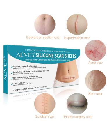 Silicone Scar Sheets - Reusable Treatment Strips for Keloids, C-Section, Surgery, Burns, and Acne - 4 Sheets - 5.9x1.6 - Best for Scar Reduction - Buy Online on GoSupps.com