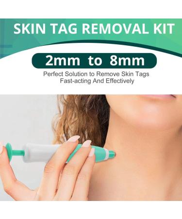 Skin Tag Remover Auto Skin Tag Removal Kit for Skin Tags (1mm - 9mm) Easy to Use Safe and Painless Remove Skin Tag with 10 Repair Patches and 40Pcs Skin Tag Removal Bands - Buy Online on GoSupps.com