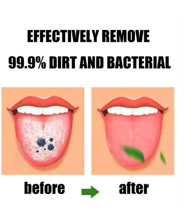 5 Pack Tongue Brush Scraper Set | Helps Fight Bad Breath | Tongue Cleaner Kit - Buy Online on GoSupps.com