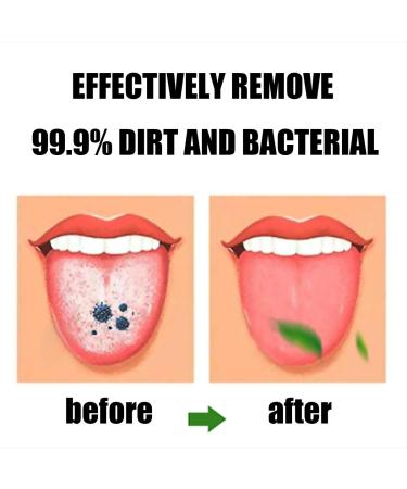 Tongue Scraper 2 Pack - Orange | Fight Bad Breath - Tongue Brush Cleaner - Buy Online on GoSupps.com