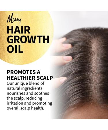 Hair Growth Oil with Rosemary Essential Oil - Rosemary Oil for Hair Growth - Treats Dry Damaged Hair - For Men & Women Promotes Thicker Fuller Hair - 100ml - Made in the UK - Ready to use. - Buy Online on GoSupps.com