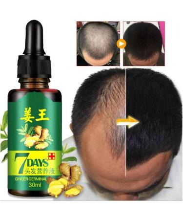  Kingknow Hair Growth Essential Oil Natural Ginger for Hair Loss Treatment Hair Growth Care Ginger Essential Oil Nourishing for Dry Damaged Hair Growth Care 30ml - Buy Online on GoSupps.com