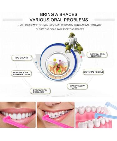 MAQ 12-Part Manual Interspace Toothbrush | Soft BPA-Free Dental Brushes for Orthodontic Bridges | Slim Design for Difficult Areas | Deep Green & White - Buy Online on GoSupps.com