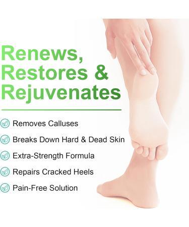 Jasmine Callus Remover Gel 8.4 oz with Pumice Stone Scrubber Kit - Professional Pedicure, Remove Hard Skin, Heels Calluses - 12 Pack - Buy Online on GoSupps.com
