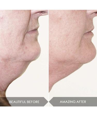 Midnight Magic Cell Serum Mini - With 100% Actives Mini + Niacinamide - Acne- Dark Spots-Rough Skin Gentle Exfoliator - Buy Online on GoSupps.com