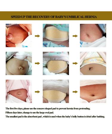 Umbilical Hernia Belt for Baby & Child - Adjustable Navel Truss Support (1 Set) - Buy Online on GoSupps.com