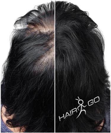  HAIR GO Premium Hair Thickening Shampoo - Hair Powder - Conditioner - For Hair Loss - 100% Natural and Vegan - 1 Pack (1 x 25g) (Dark Blonde) - Buy Online on GoSupps.com