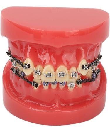 Orthodontic Bracket Model - 24 Teeth Demonstration Model with Metal Wires & Brackets for Dental Education - Buy Online on GoSupps.com