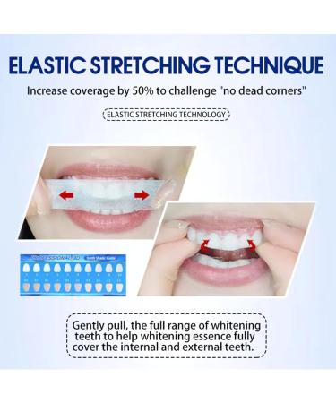 Elunara Bandes de blanchiment des dents blanches 5D bandes blanches de blanchiment des dents bandes blanches efficaces sensibilit r duite sans sensibilit id ales pour les voyages (2) - Buy Online on GoSupps.com