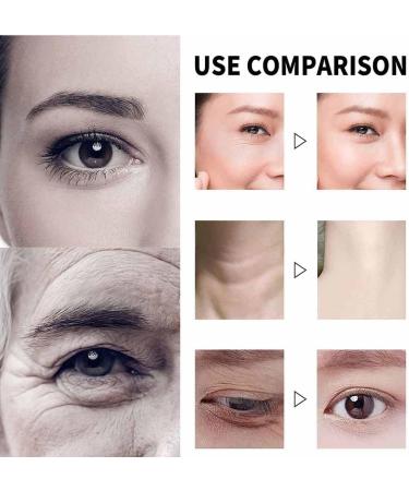 Harvey Ross Miracle Retinol Harvey Ross Miracle Retinol Moisturizer Harvey Ross Anti-Wrinkle Face Cream Reduces Wrinkles And Firms Skin Anti-Aging Face Moisturizer - Buy Online on GoSupps.com