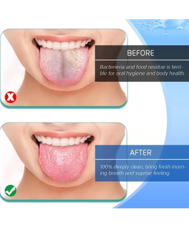 PLABBDPL Tongue Scraper Set - 4 Colorful Tongue Cleaners for Adults | Best Oral Hygiene Tool for Fresh Breath - Buy Online on GoSupps.com