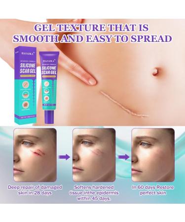  HASAIKA Scar gel cream for new and old scars smooth and hydrated skin 40 g - Buy Online on GoSupps.com