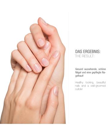 VITABAY Shea Nail Butter 2x20ml - Nourishing Nail Cream with Biotin & Vitamin B7 for Stronger Healthier Nails - Moisturizes & Protects Against Brittleness & Dry Skin - Ideal for Hand & Foot Care - Buy Online on GoSupps.com