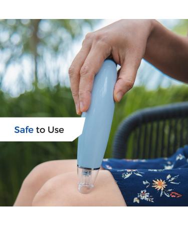 Effective Mosquito Bite Relief Tool - Battery-Powered Suction Pump for Instant Itch Relief | Compare to Bug Bite Thing - Buy Online on GoSupps.com
