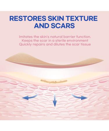 Silicone Scar Removal Sheets for Old & New Scars - 6 Sheets (2 Sizes) - Effective Treatment - Diverse Scars - 5.9 x 1.57 & 2.95 x 1.57 - Buy Online on GoSupps.com