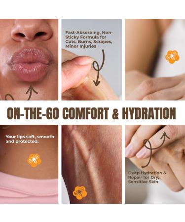 Honey for Healing On-the-Go Essentials Travel Buddies Duo & Natural Lip Balm - Buy Online on GoSupps.com