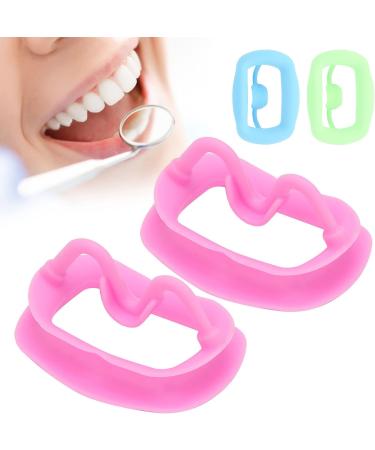 Portable Silicone Cheek Retractor - 2pcs Reusable Dental Mouth Opener for Oral Inspection (Blue) - International Shipping Available - Buy Online on GoSupps.com
